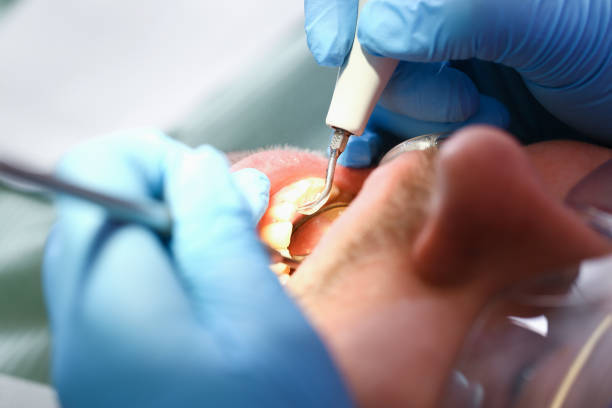 Best Emergency Broken Tooth Repair in Hooper, NE